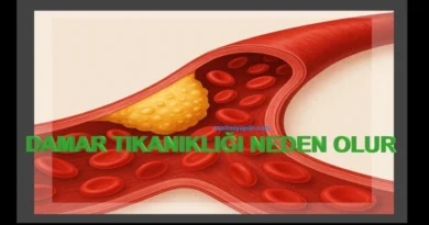 Damar Tıkanıklığı Neden Olur, Belirtileri Nelerdir?